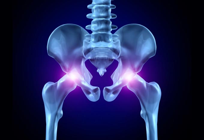 Χειρουργική Ισχίου