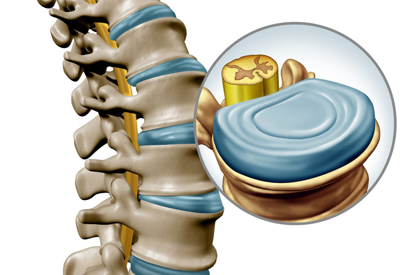 Χειρουργική Σπονδυλικής Στήλης